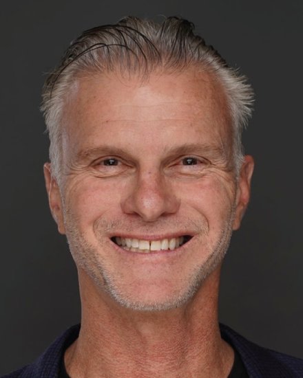 Doug Renert